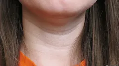 Revela a idade num instante: como eliminar as rugas em forma de anéis de Vénus no pescoço